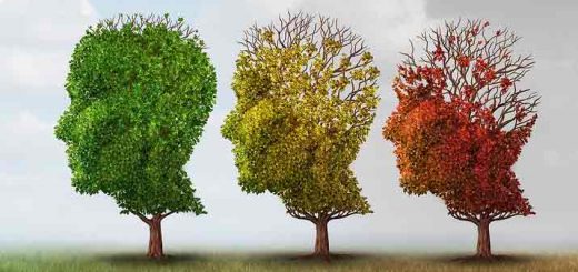 Alzheimer